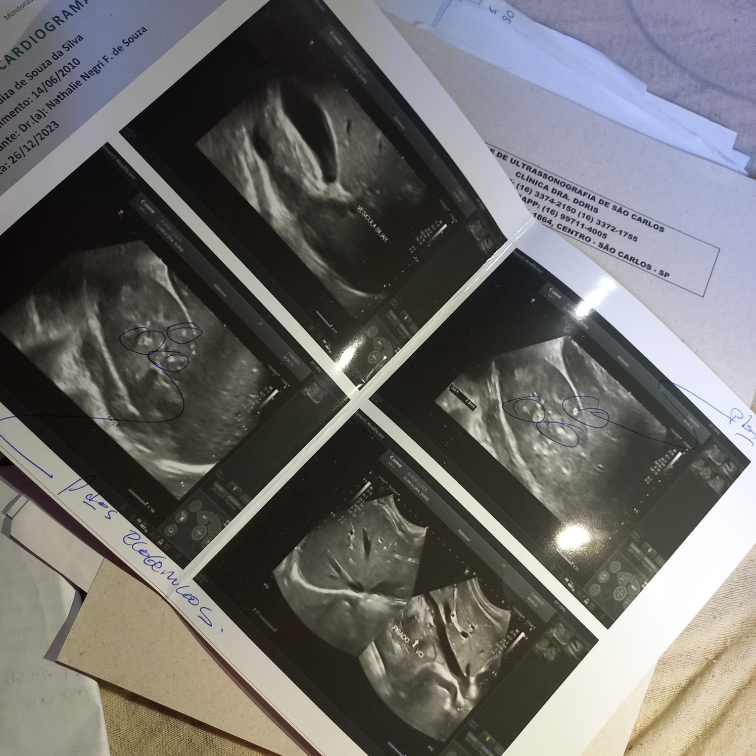 aa650c3d-07cf-4e00-ab6f-6c0a6afd439b