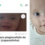 Anna Lis precisa de ajuda para crescer com saúde