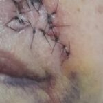 Paciente com câncer precisa da sua ajuda