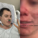 Vítima de agressões em em festa universitária sai da UTI e manda recado para os fãs