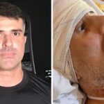 Piloto baleado na cabeça morre após ficar meses lutando pela vida